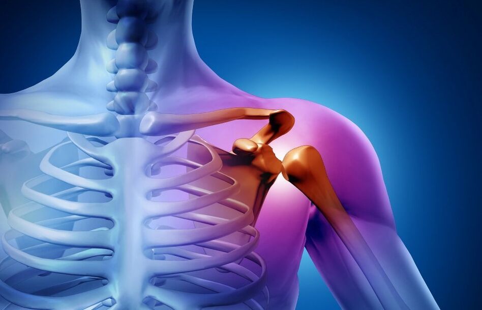 ozljeda ramenog zgloba zbog artroze