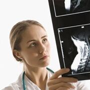 Dijagnoza osteohondroze navedena je korištenjem X -tray -a